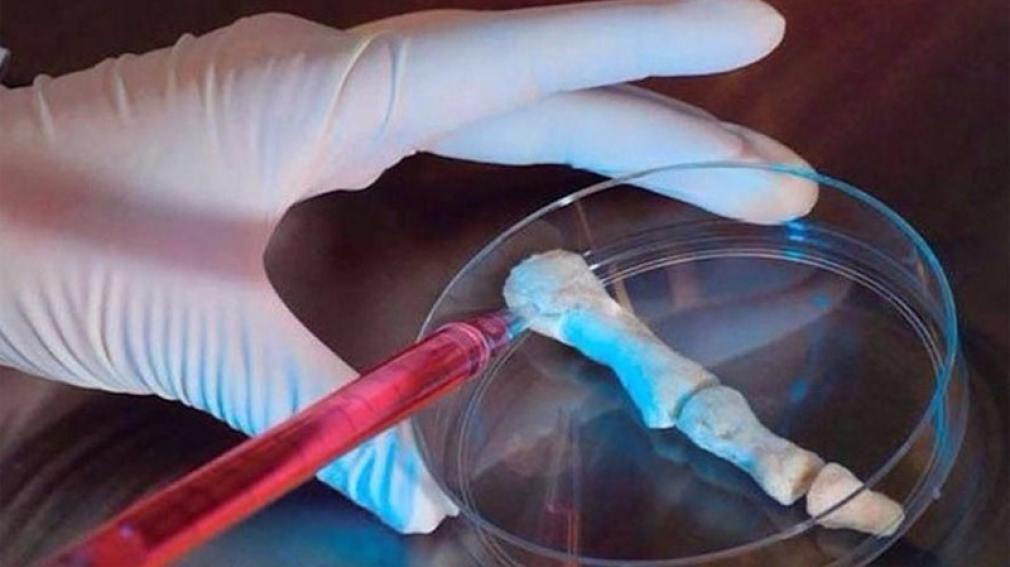 Científicos rosarinos crearon un gel que regenera los huesos