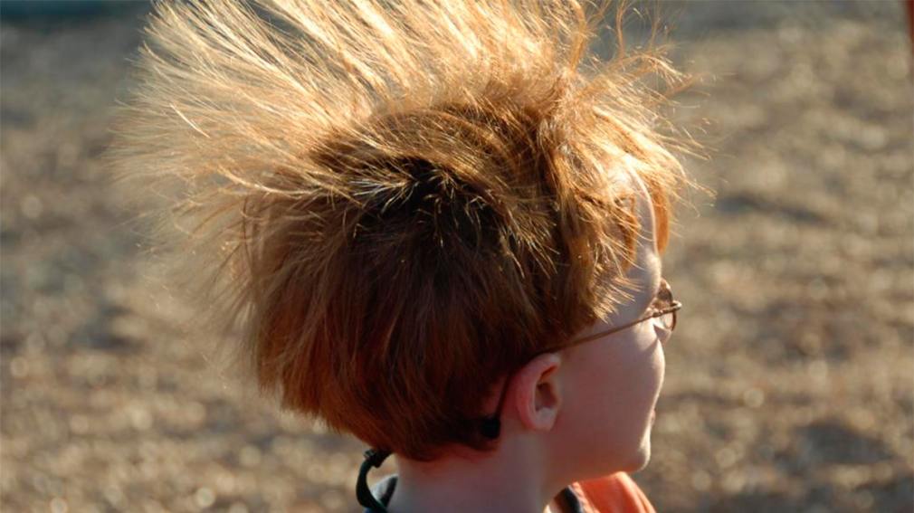 Síndrome de cabello impeinable, el problema que afecta sobre todo a los chicos