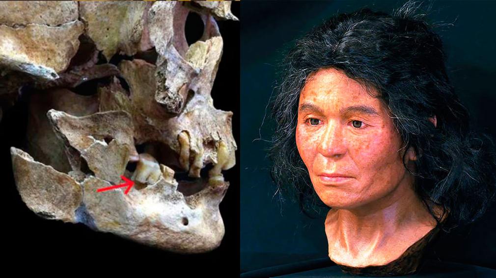 A partir de ADN extraído de una muela de 3.600 años reconstruyeron el rostro de una mujer 