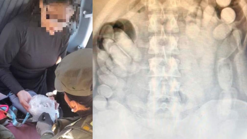 Detuvieron a una boliviana con más de 100 cápsulas de cocaína en su estómago
