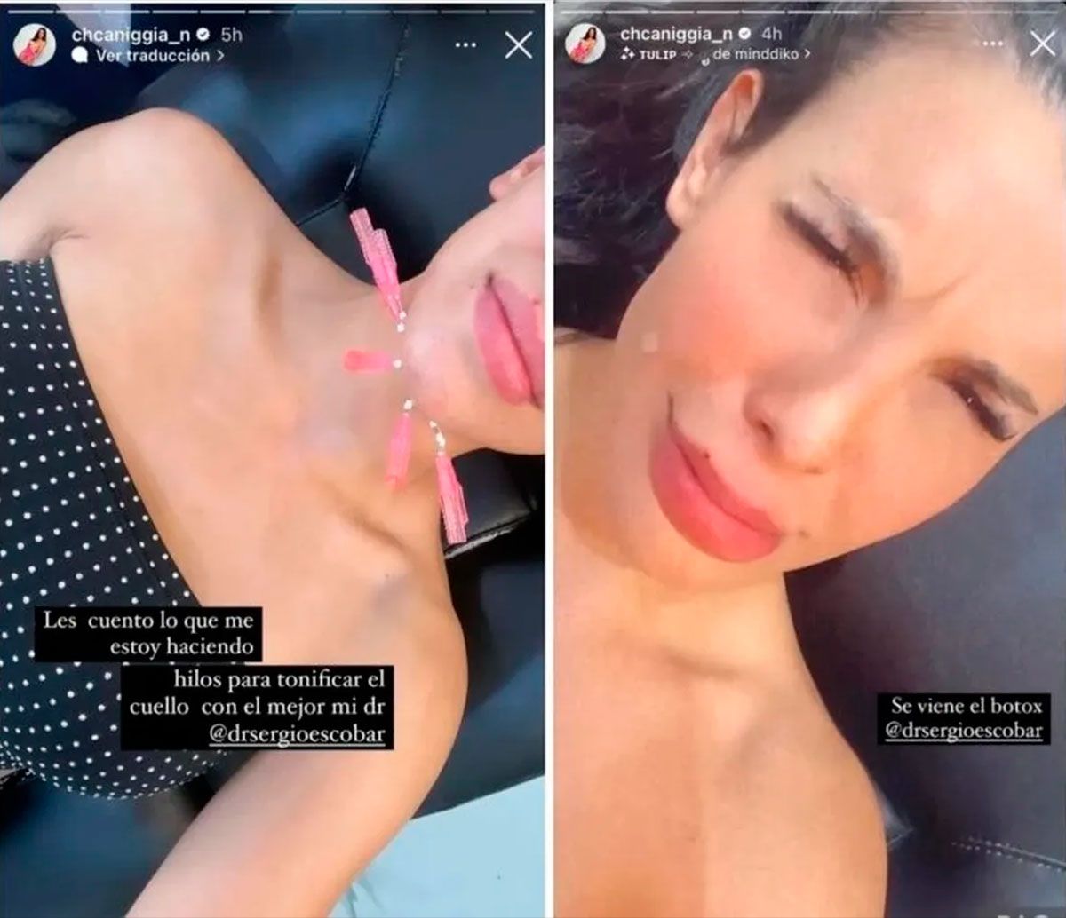 Charlotte Caniggia pasó por el quirófano y mostró los retoques estéticos -  Diario Panorama Movil